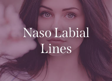 Naso Labial Lines