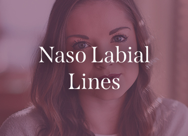 Naso Labial Lines